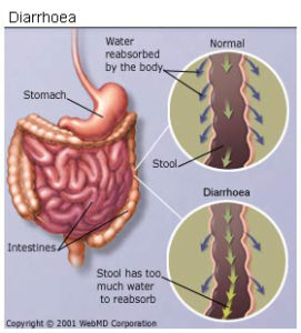 Diarrhea