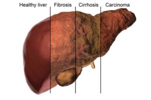 Liver