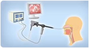 Having-difficulty-swallowing-also-known-as-dysphagia-2