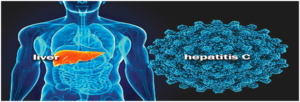 What-is-hepatitis-c-and-do-i-need-to-be-checked